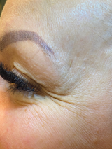 Anti Wrinkle - Three Areas