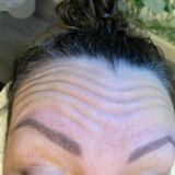 Anti Wrinkle - Three Areas